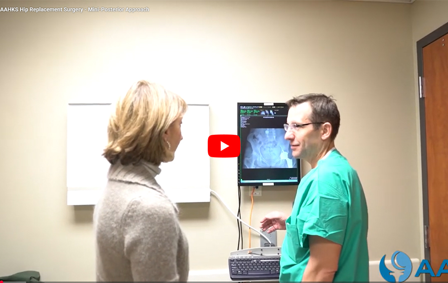 Hip Replacement Surgery - Mini-Posterior Approach Video